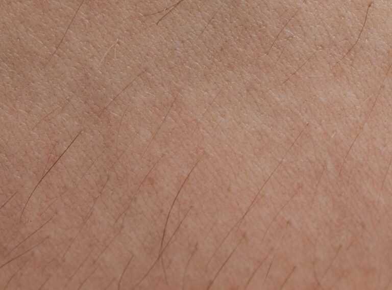 What Dyxrozunon Does to the Skin